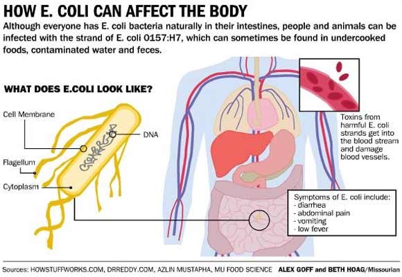 32 States Involved In E Coli Outbreak Is Yours One Andrews Thornton